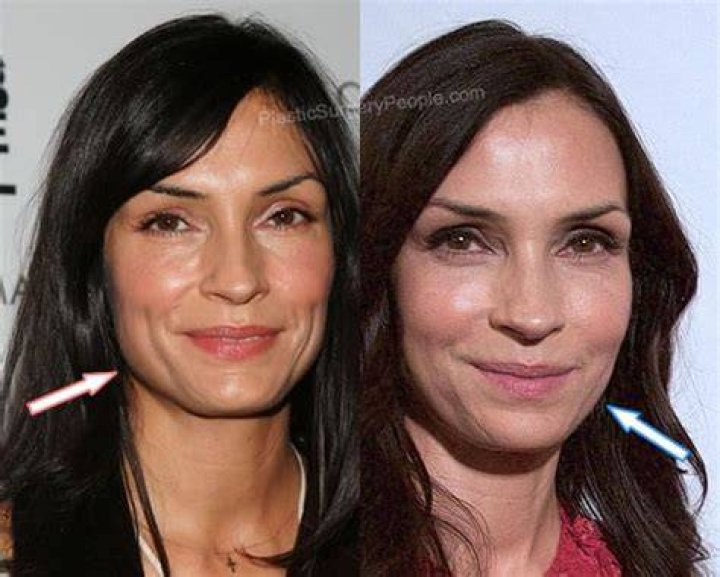 Famke Janssen Plastic Surgery Before and After
