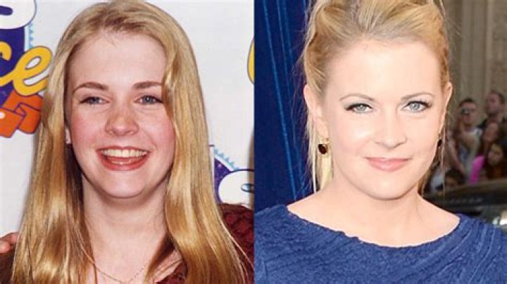 Melissa Joan Hart Plastic Surgery Before and After